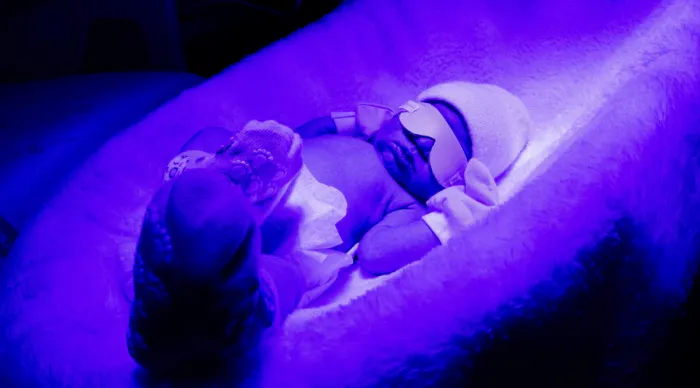 Com equipe treinada e tecnologia adequada, unidade de alto risco assegura diagnóstico precoce e tratamento eficaz da icterícia neonatal // Fotos: Ascom SES