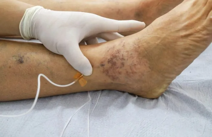 Foto: Reprodução/Prefeitura de Petrolina - PE