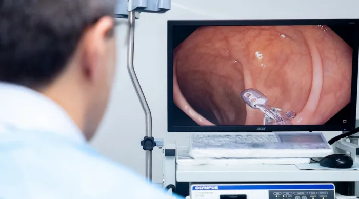 Mutirão de exames de colonoscopia fortalece combate ao câncer colorretal em Sergipe