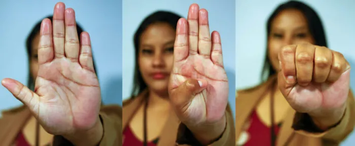 Código Universal do Sinal de Socorro consiste em apresentar a mão com a palma voltada para fora em direção à pessoa para a qual pede ajuda, dobrar o polegar para dentro e fechar os outros dedos sobre o polegar