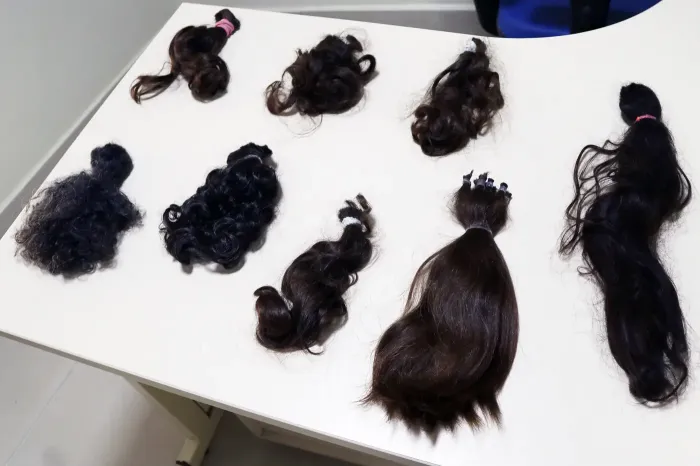 Doações de cabelos ajudam na auto estima das vítimas de acidentes por escalpelamento