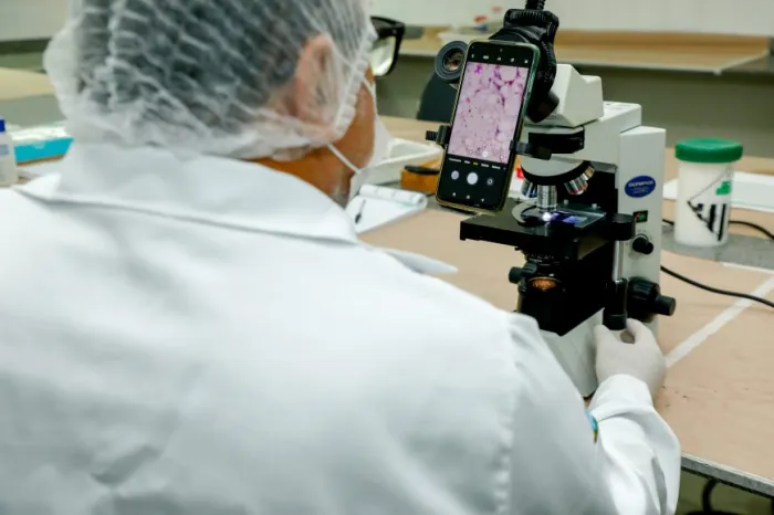 Análises laboratoriais auxiliam no diagnóstico e no monitoramento da doença de Chagas em Rondônia