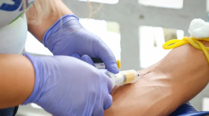 Secretaria de Estado da Saúde promove capacitação sobre vigilância e manejo clínico do HTLV