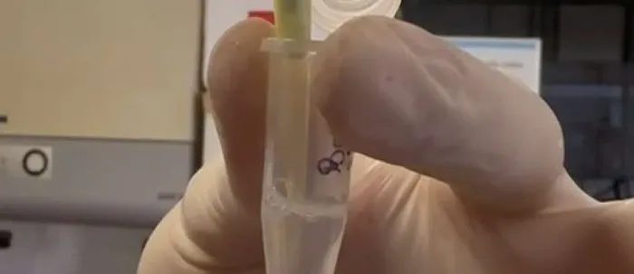 Tratamento inédito será aplicado pela Uece em crianças com Síndrome de Rett