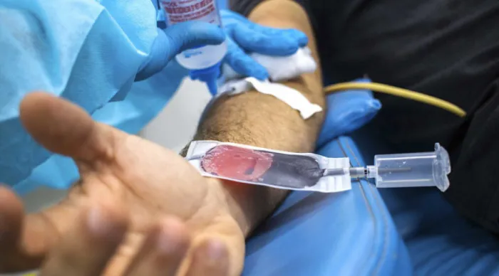 Hemose reforça importância da doação de sangue para pacientes com doença falciforme