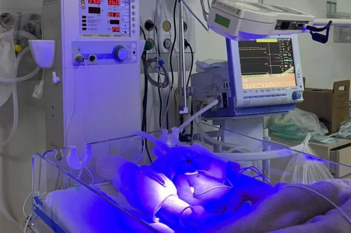 Hospitais públicos do Estado implantam primeiras unidades de UTI Neonatal Neurológica