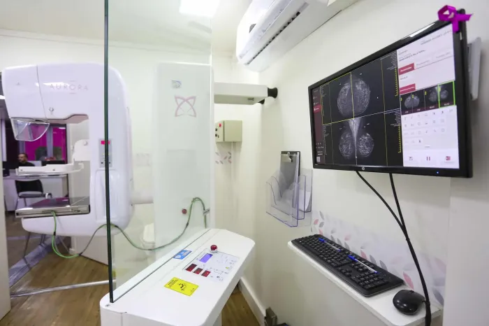 Veja os 15 municípios paulistas que recebem carretas com exames de mamografia gratuitos