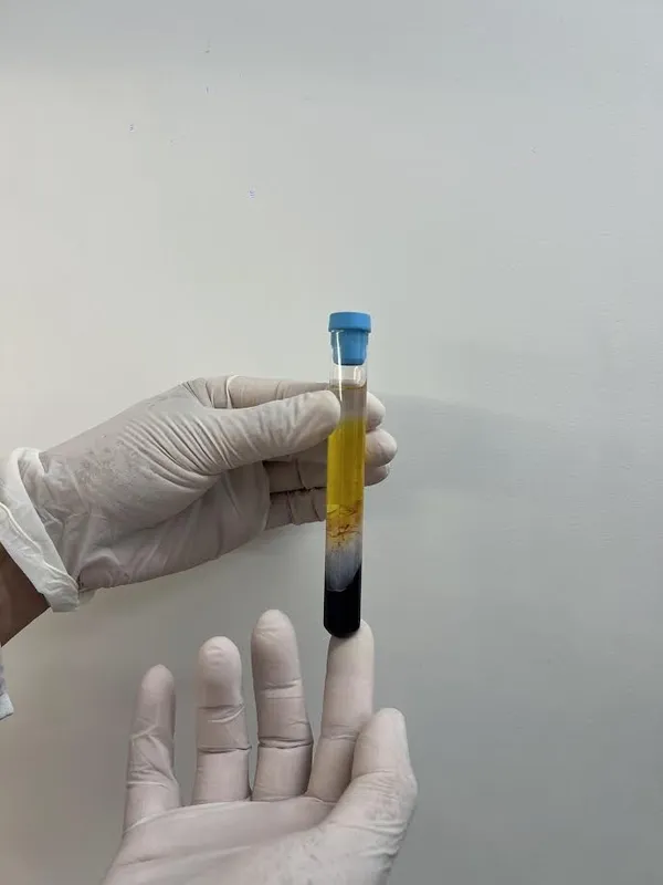 Divulgação Medil/Dr. Gabriel Ferraz Ferreira
