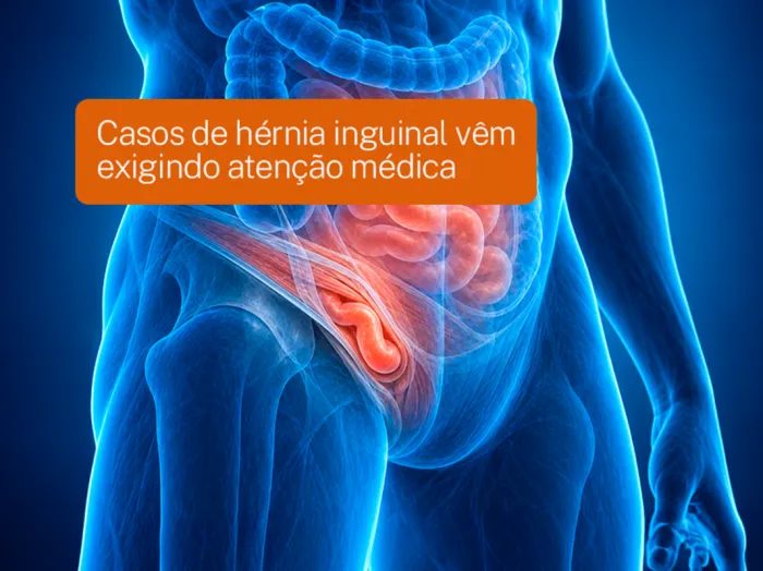 Casos de hérnia inguinal vêm exigindo atenção médica