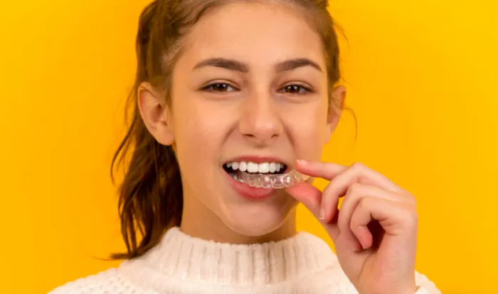 Divulgação/SouSmile