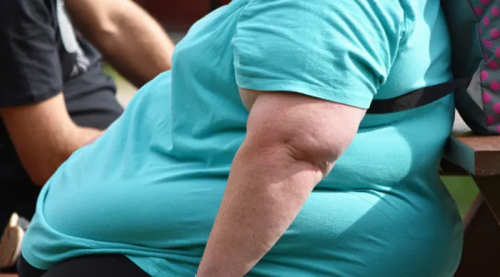 SES reforça importância da prevenção e do cuidado com a obesidade